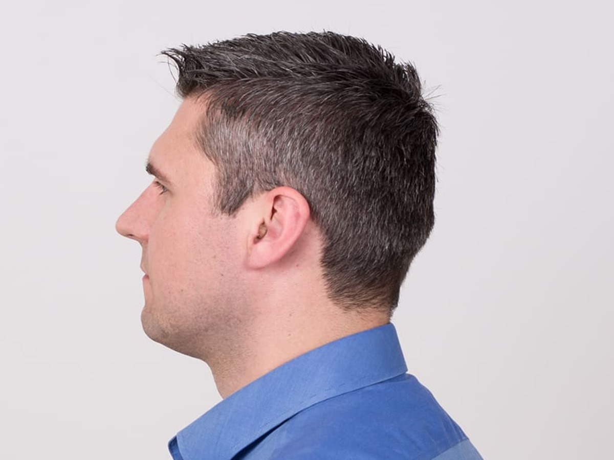 man with severe hearing loss wearing hearing aids