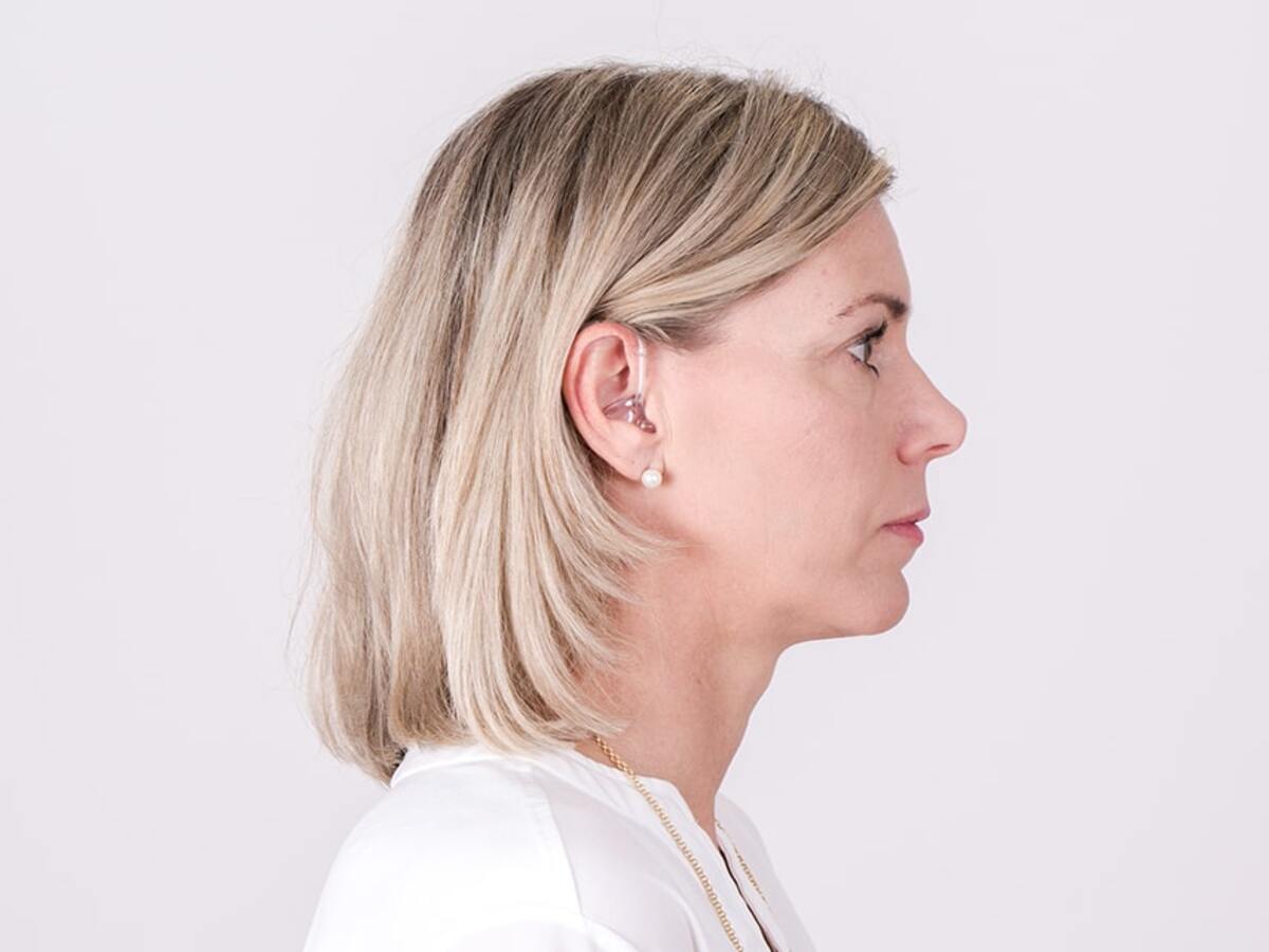 woman wearing bte hearing aids