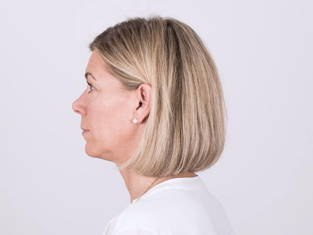 woman wearing cros aid that fits in ear canal